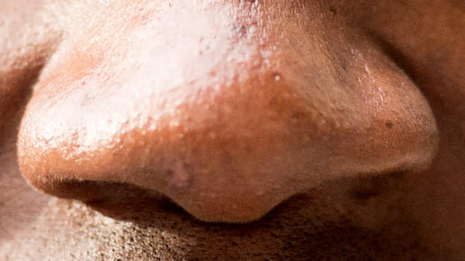Neue Studienergebnisse: Die Nasenform hängt auch vom Klima ab Die Nase eines Afrikaners.